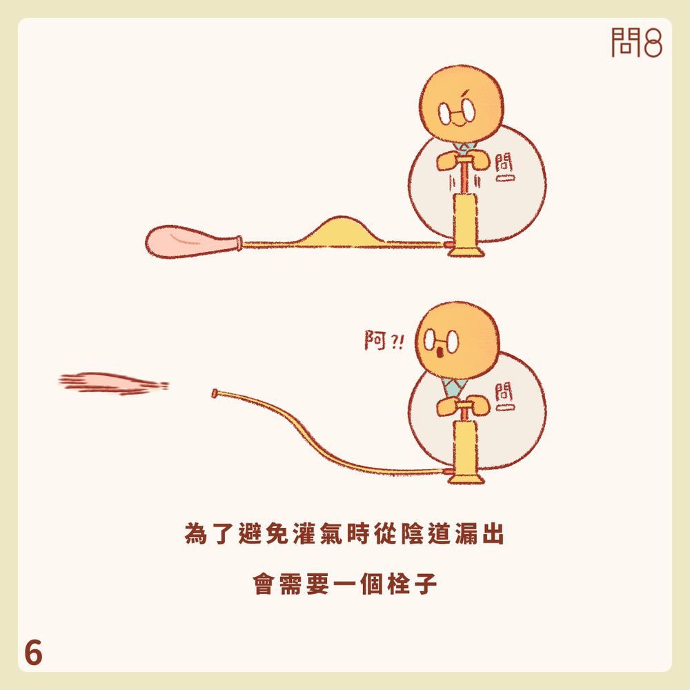 什麼是自然孔內視鏡手術(NOTES)?